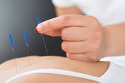 Akupunktur Medik Untuk Kesehatan Reproduksi Pria